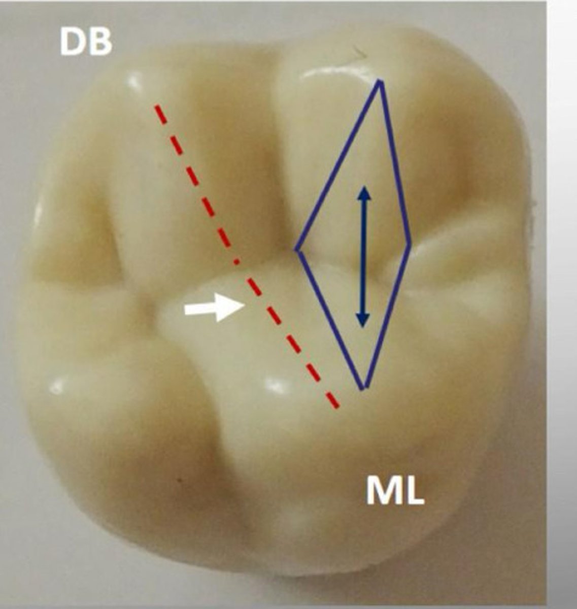 <p>found only on maxillary molars made of the triangular ridges of the mesiolingual and distobuccal cusps</p>