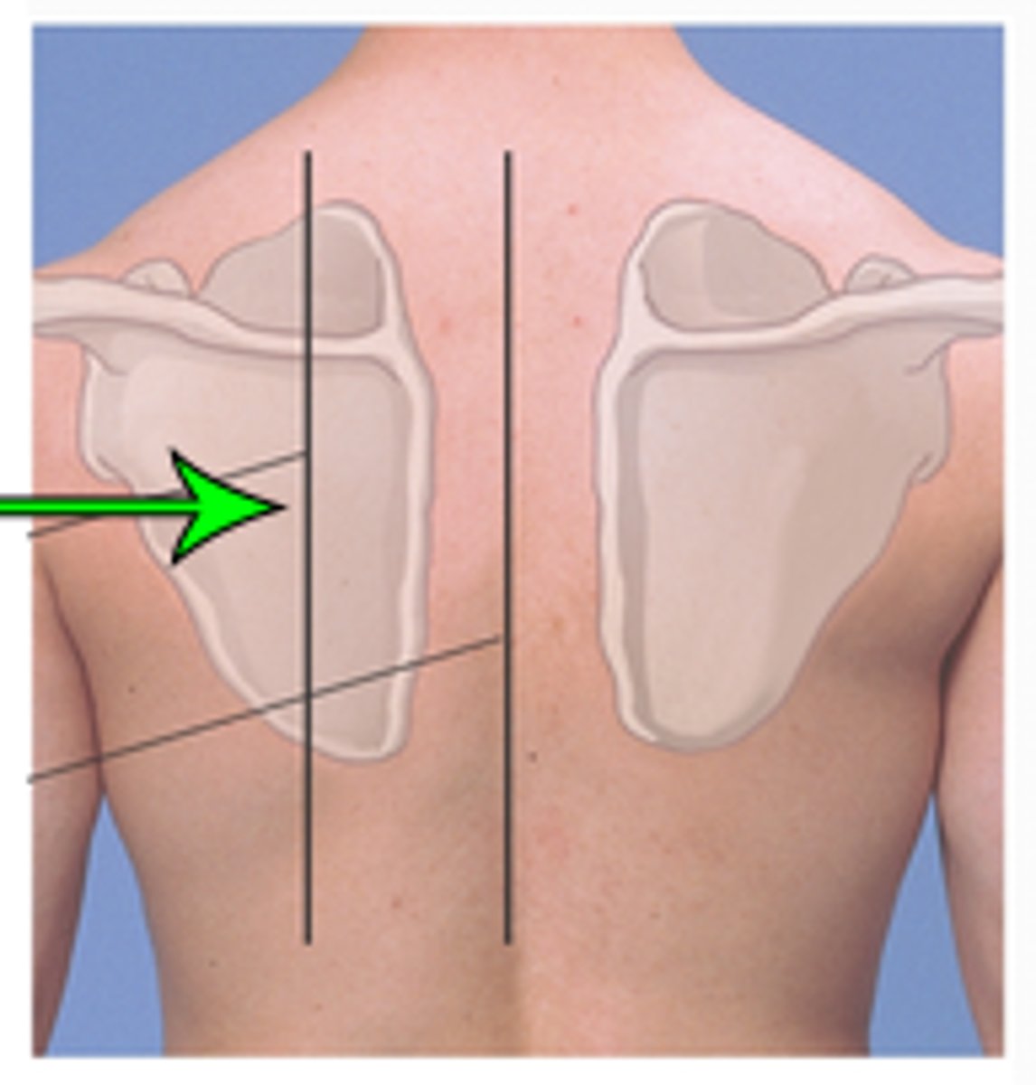 <p>extends through the inferior angle of the scapula when the arms are at the sides of the body</p>