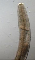 <p><span style="line-height: 115%;"><span>Dictyocaulus viviparous</span></span></p><p><span style="font-family: Calibri, sans-serif;"><span>- </span></span>Brown, bent spicules</p><p class="MsoListParagraphCxSpLast"><span style="line-height: 115%;"><span>Tachypnoea, dyspnea, dry cough, ‘air hunger’, wt loss</span></span></p><p class="MsoListParagraphCxSpLast">Dx: CS, hx</p><p class="MsoNormal">Tx: BZD, leva, ML</p>