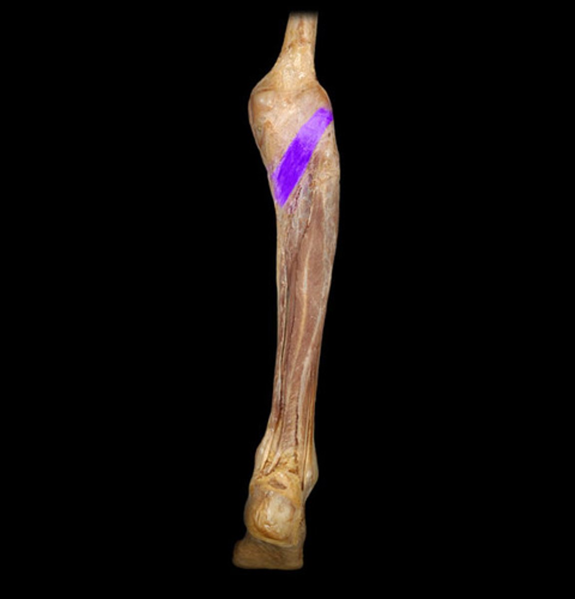 <p>Found under the gastrocnemius and plantaris, it runs obliquely and weakly rotates the knee medially.</p>