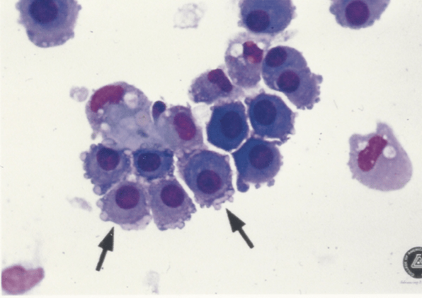 <p>Identify the cells in this body fluid</p>