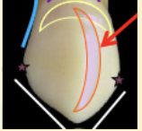 <p><mark data-color="green" style="background-color: green; color: inherit">maxillary canines #6 and #11; mesial contact</mark></p>