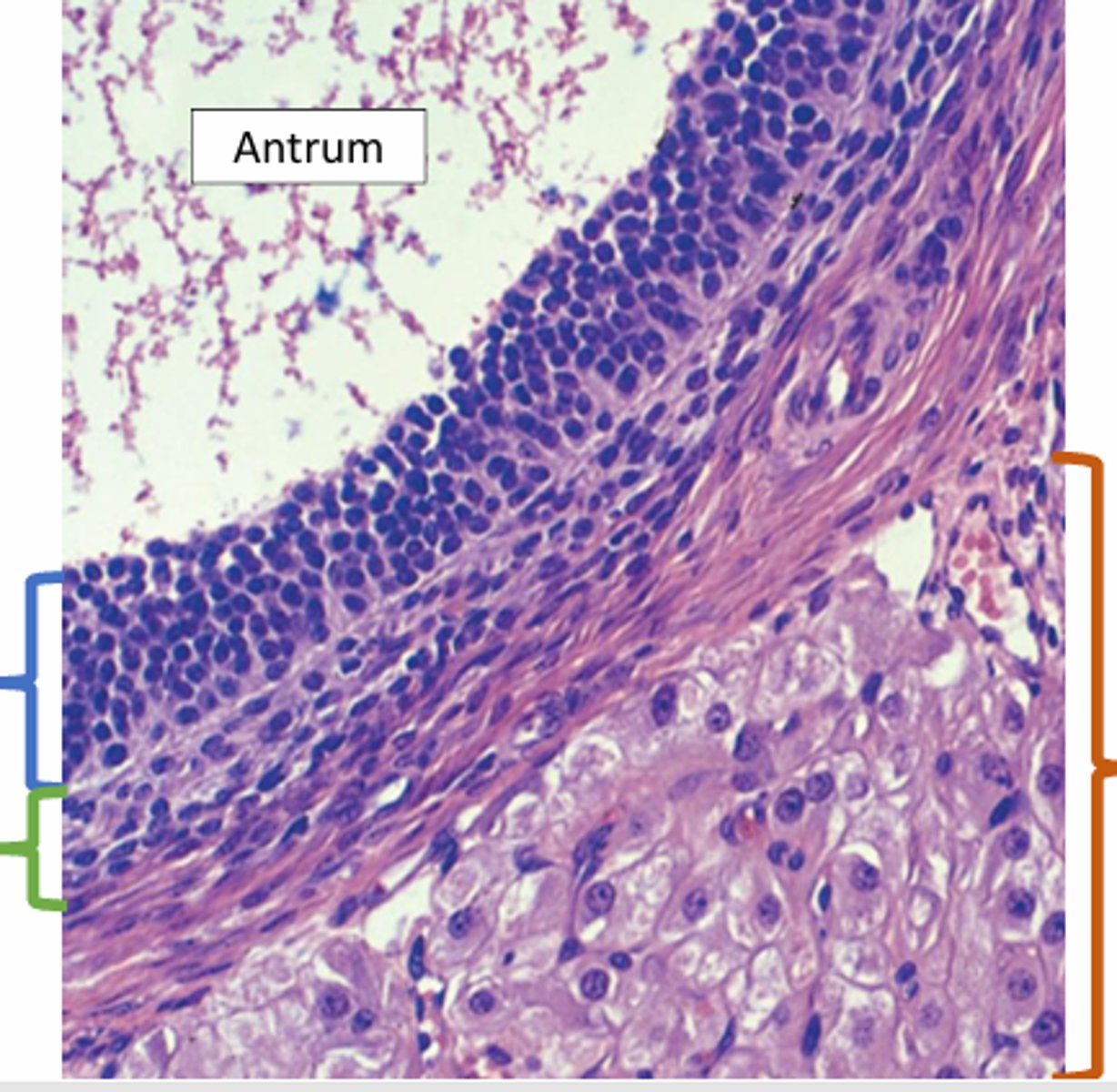 <p>the red brackets indicate _____</p>