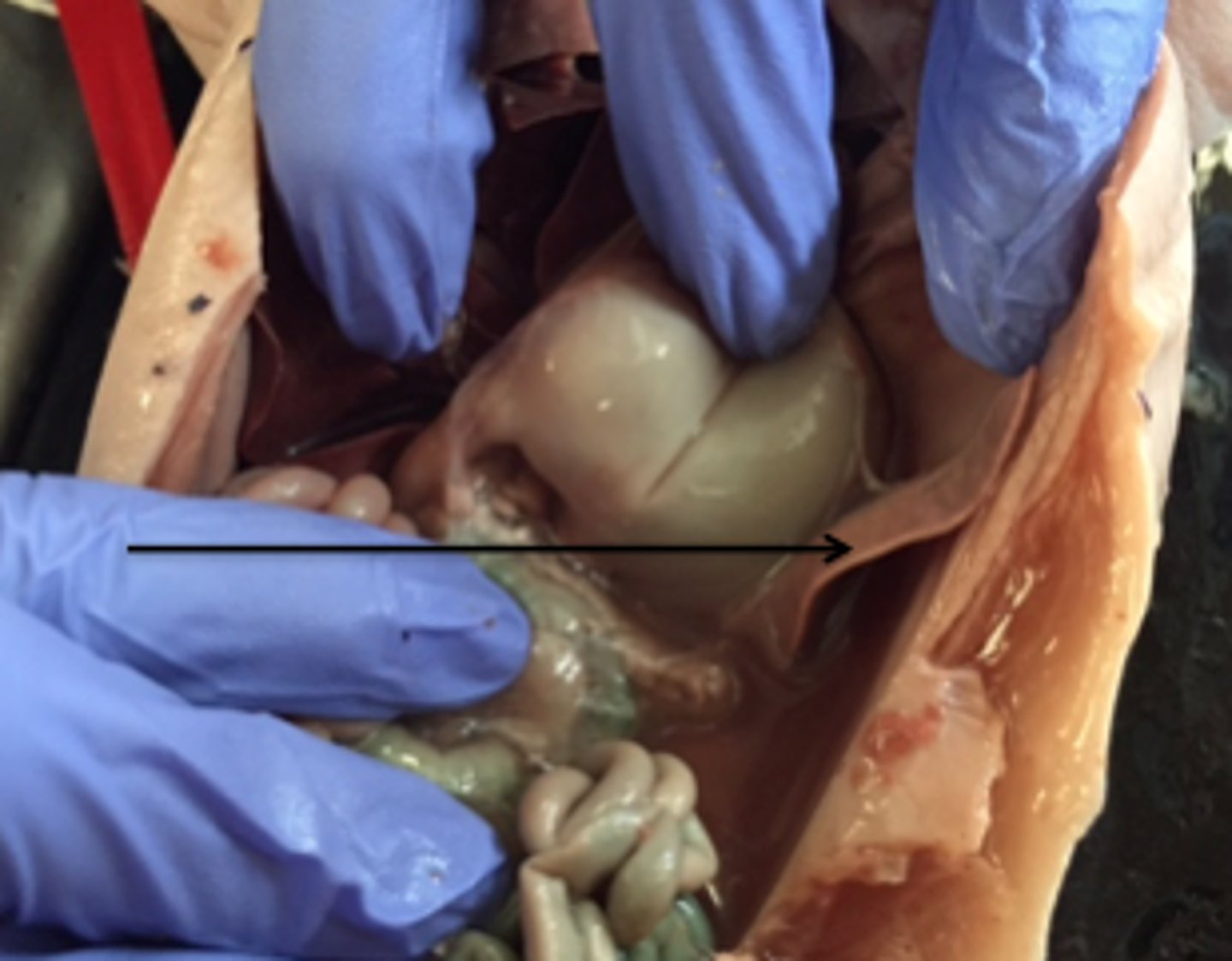 <p>What organ is this and what is its function?</p>