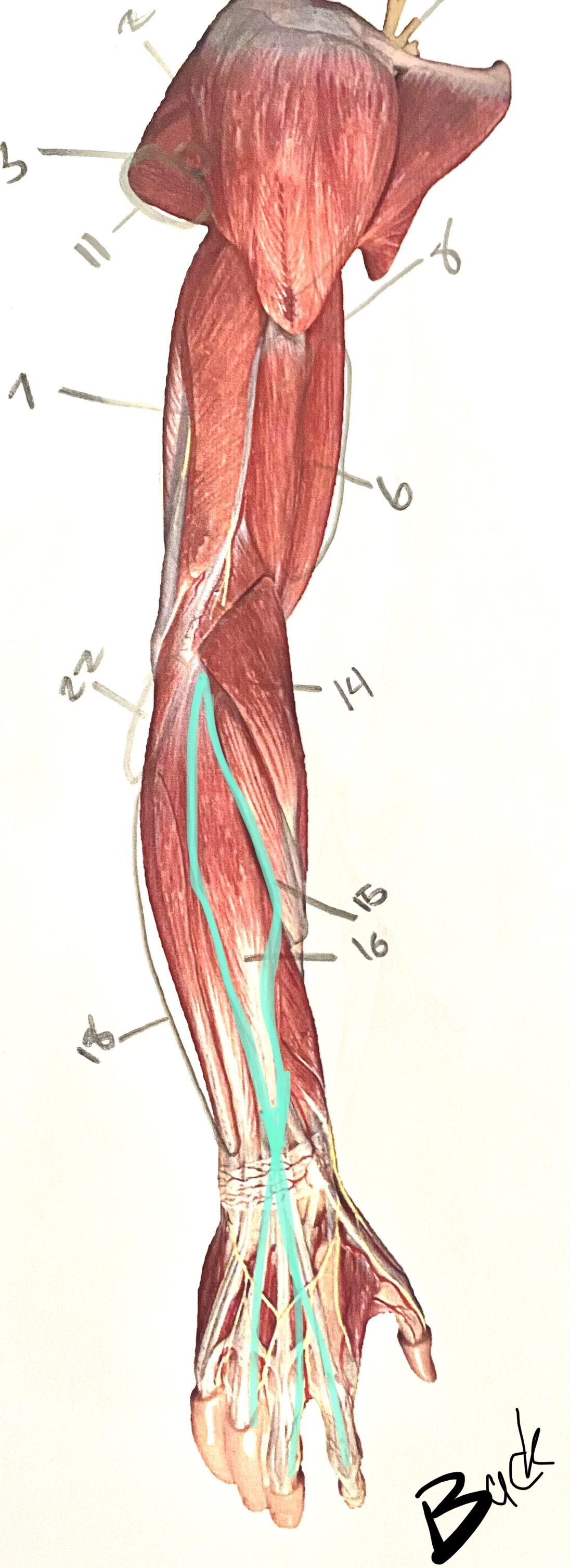 <p>Connect to 3 fingers</p>