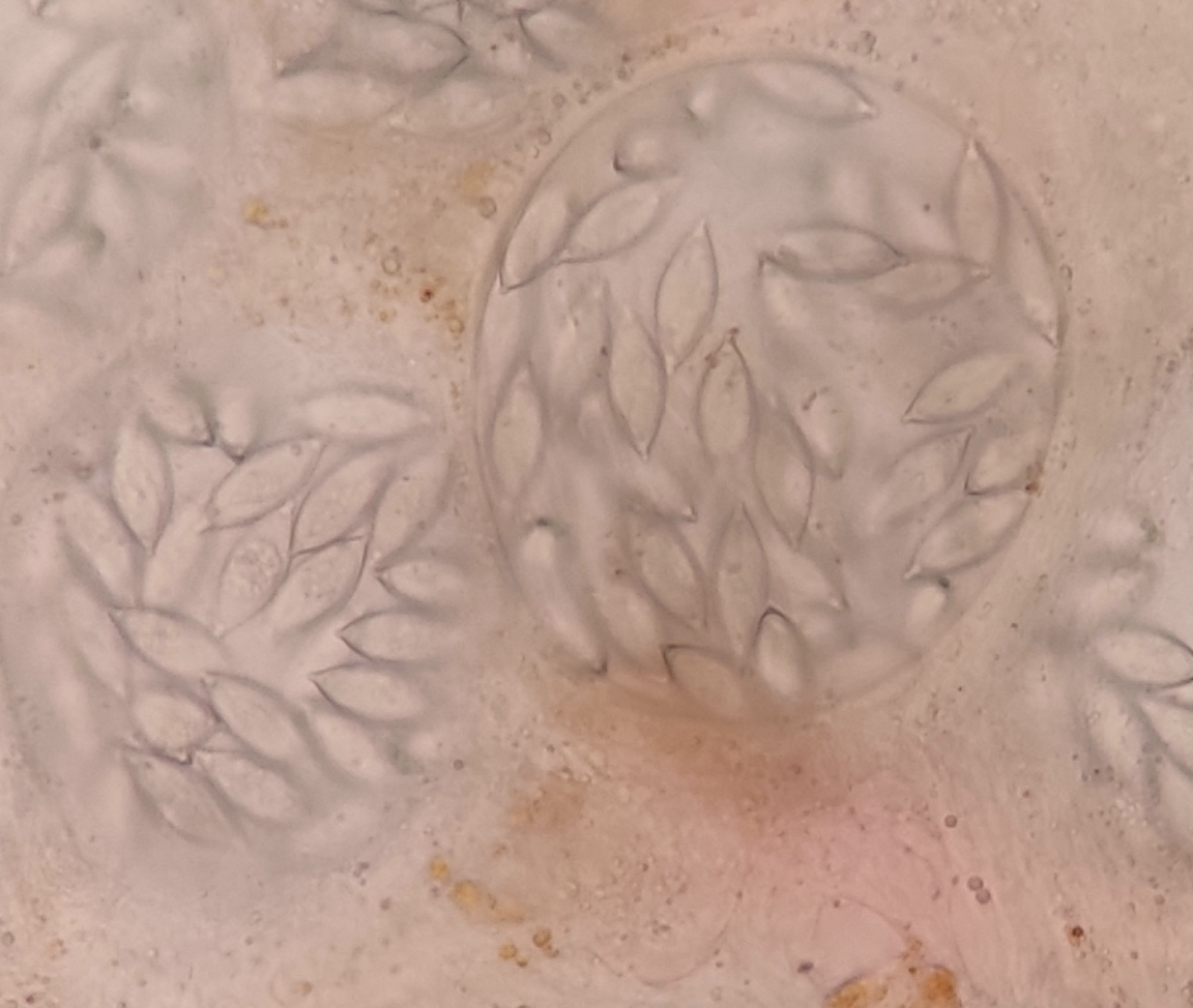 <p>What stage and type of parasite does the image depict? </p>