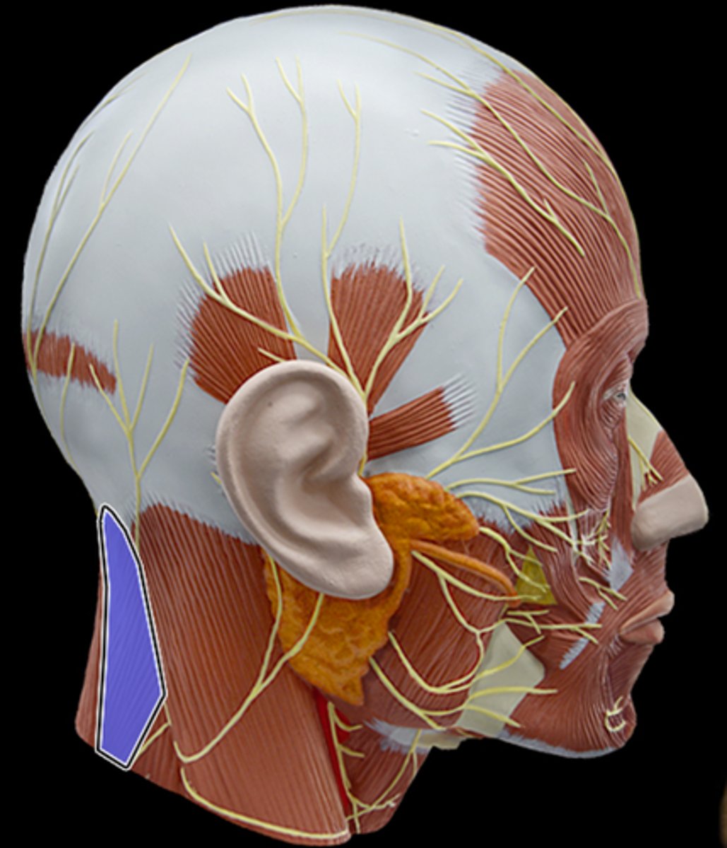 <p>What Muscle Is Highlighted?</p>