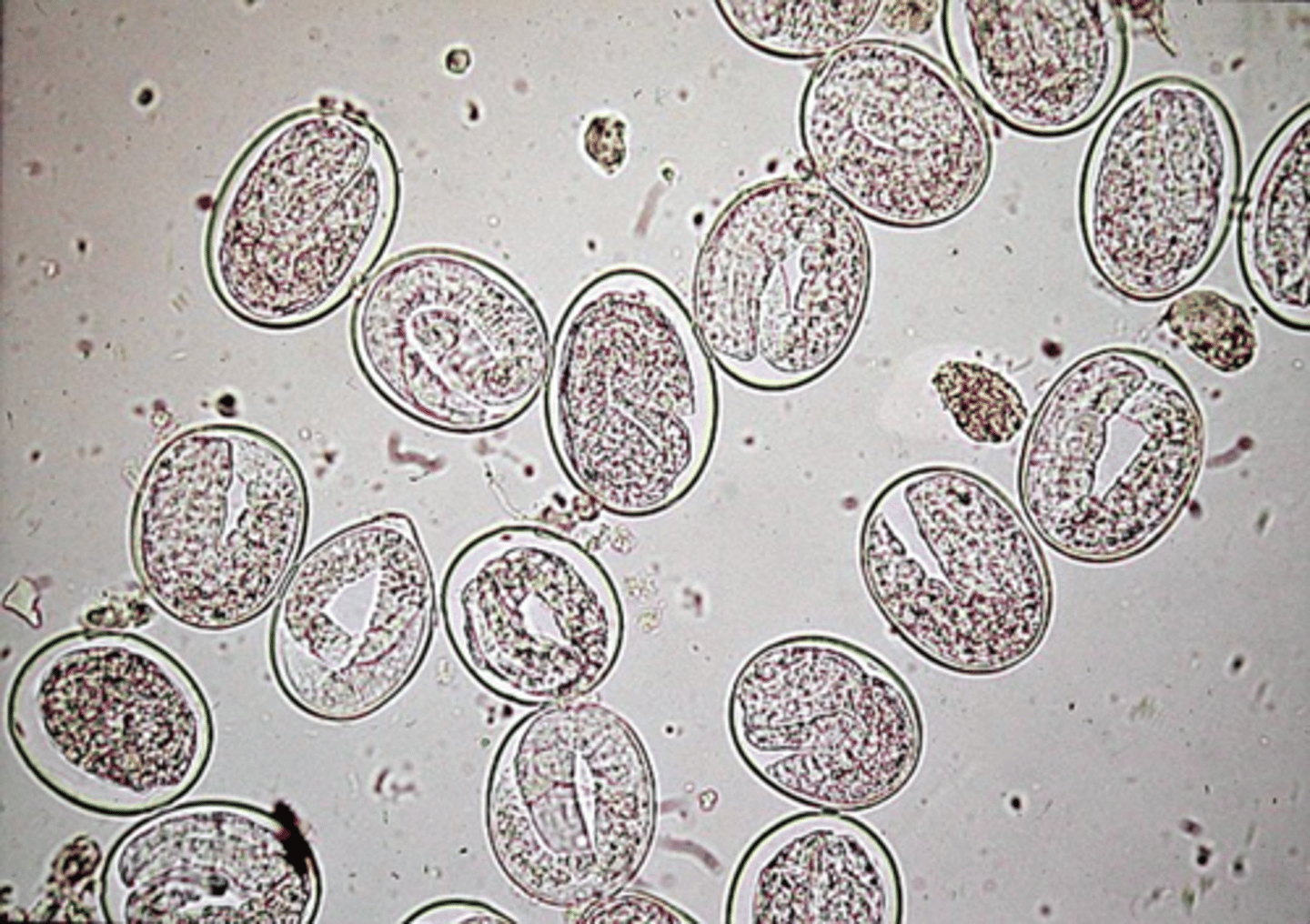 <p>eggs and larvae are shed inn the feces of infected hosts. contracted via skin penetration or larvae or eggs. they will migrate to the lungs to be coughed up and swollowed to continue the life cycle. they are diagnosed by the visualization of eggs in a fecal analysis (floating and/ or smear)</p>
