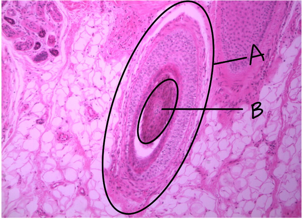 <p>Thin skin</p><ul><li><p>from scalp</p></li></ul><p></p><p>A: hair follicle</p><p>B: root of hair follicle&nbsp;</p><p></p>