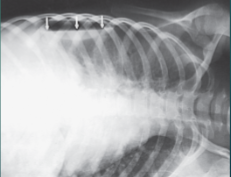 <p>What projection, position, and anatomy is this?</p>