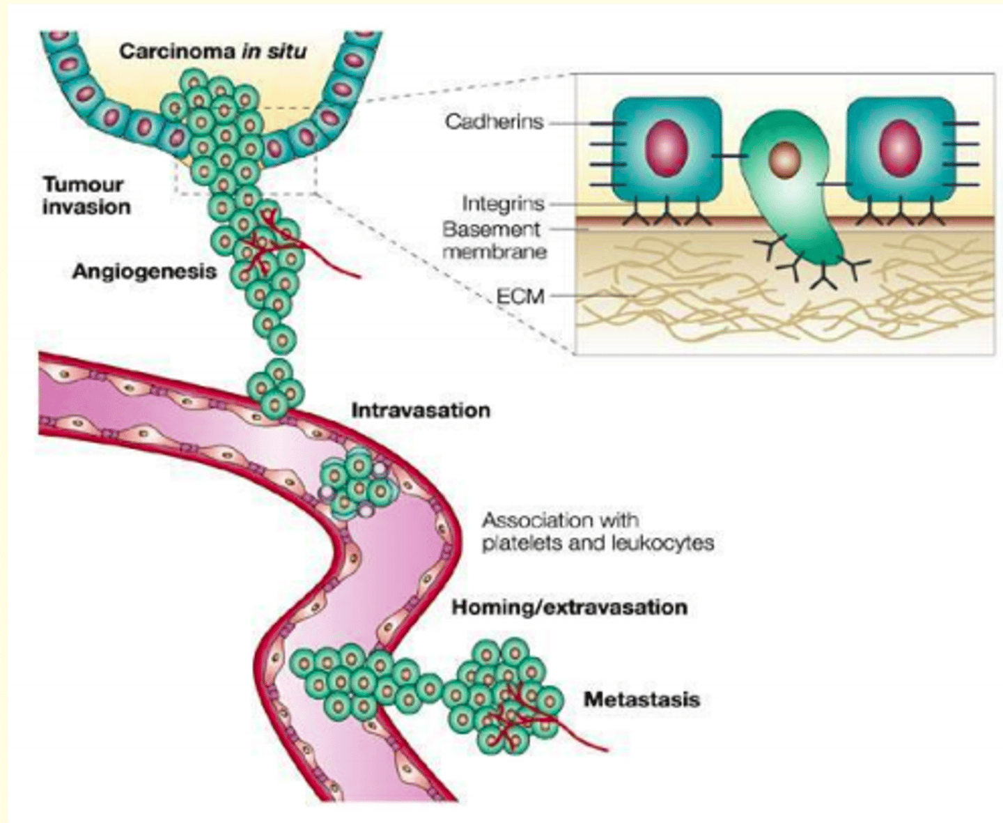<p>1) Detachment of tumour cells from one another by unzipping of the anchor protein E-cadherin</p><p>2) Degradation of the ECM by collagenase which attacks the collagen fibres of the basement membrane</p><p>3) Loss of adhesion of cells from integrins</p><p>4) Migration of tumour cells through ECM </p>