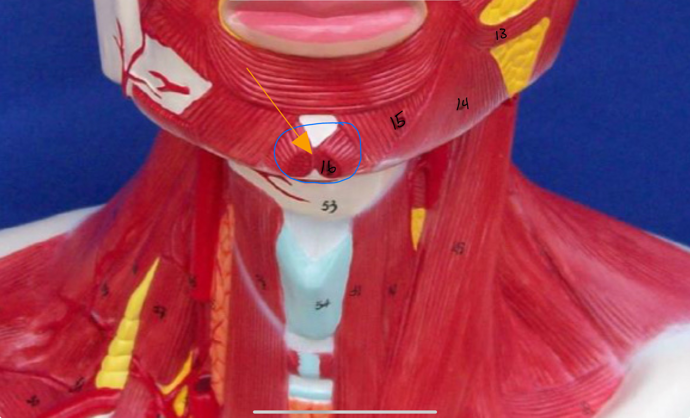 <p>What type of muscle is this (altay model )</p>
