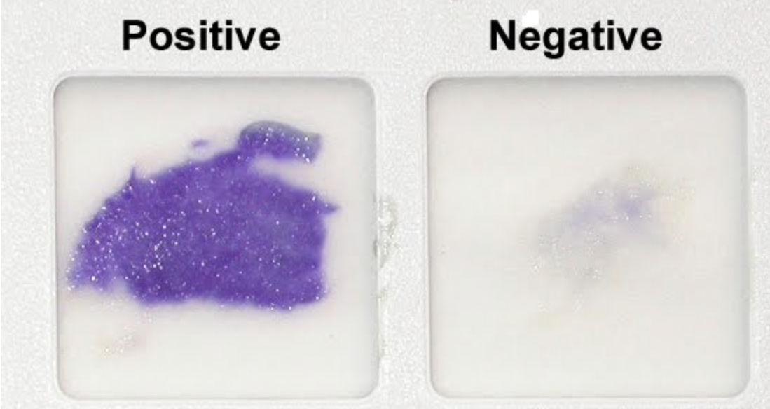 <p>What test is this?</p>