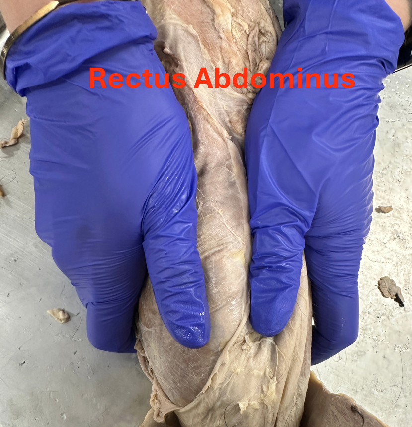 <p>Rectus abdominis (abdominal muscles)</p>