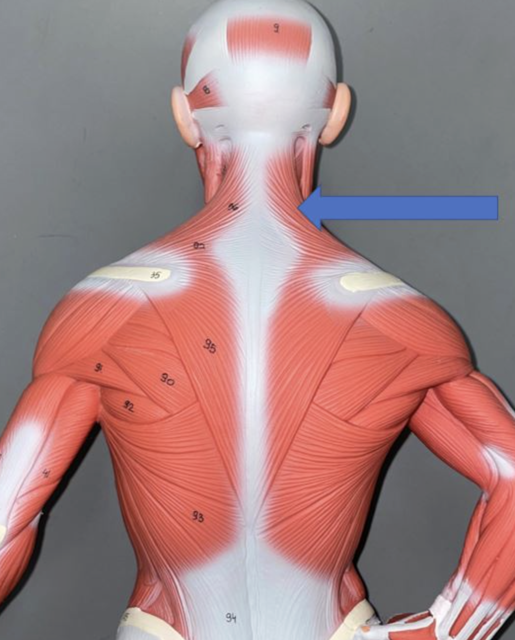 <p>muscle name & action</p>