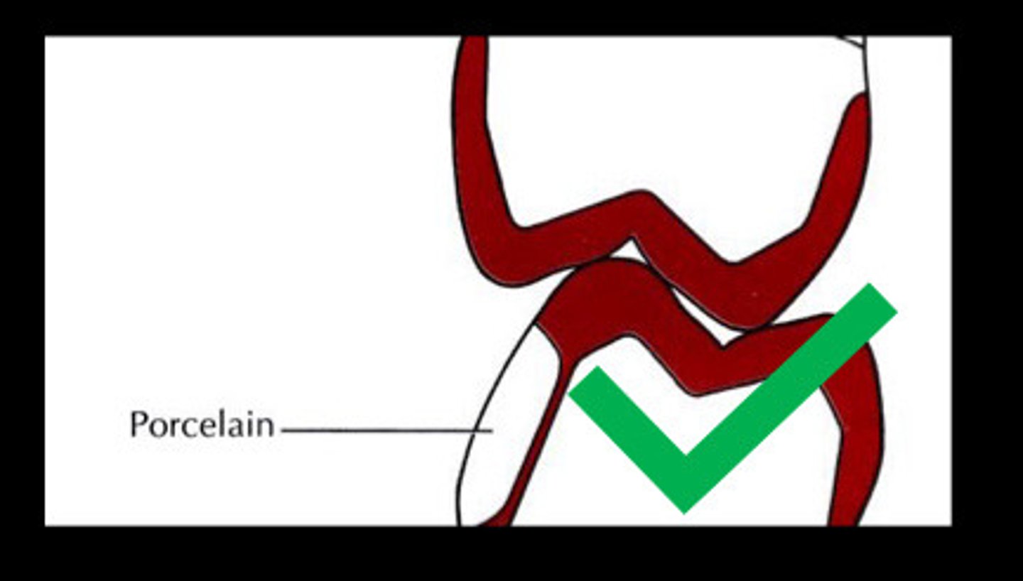 <p>Metal ceramic interface must be</p><p>ideally at least __ from all</p><p>centric occlusal contacts.</p>