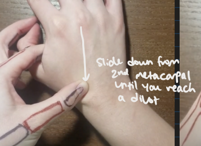 <p>slide down from the 2nd metacarpal until you reach a divot </p>