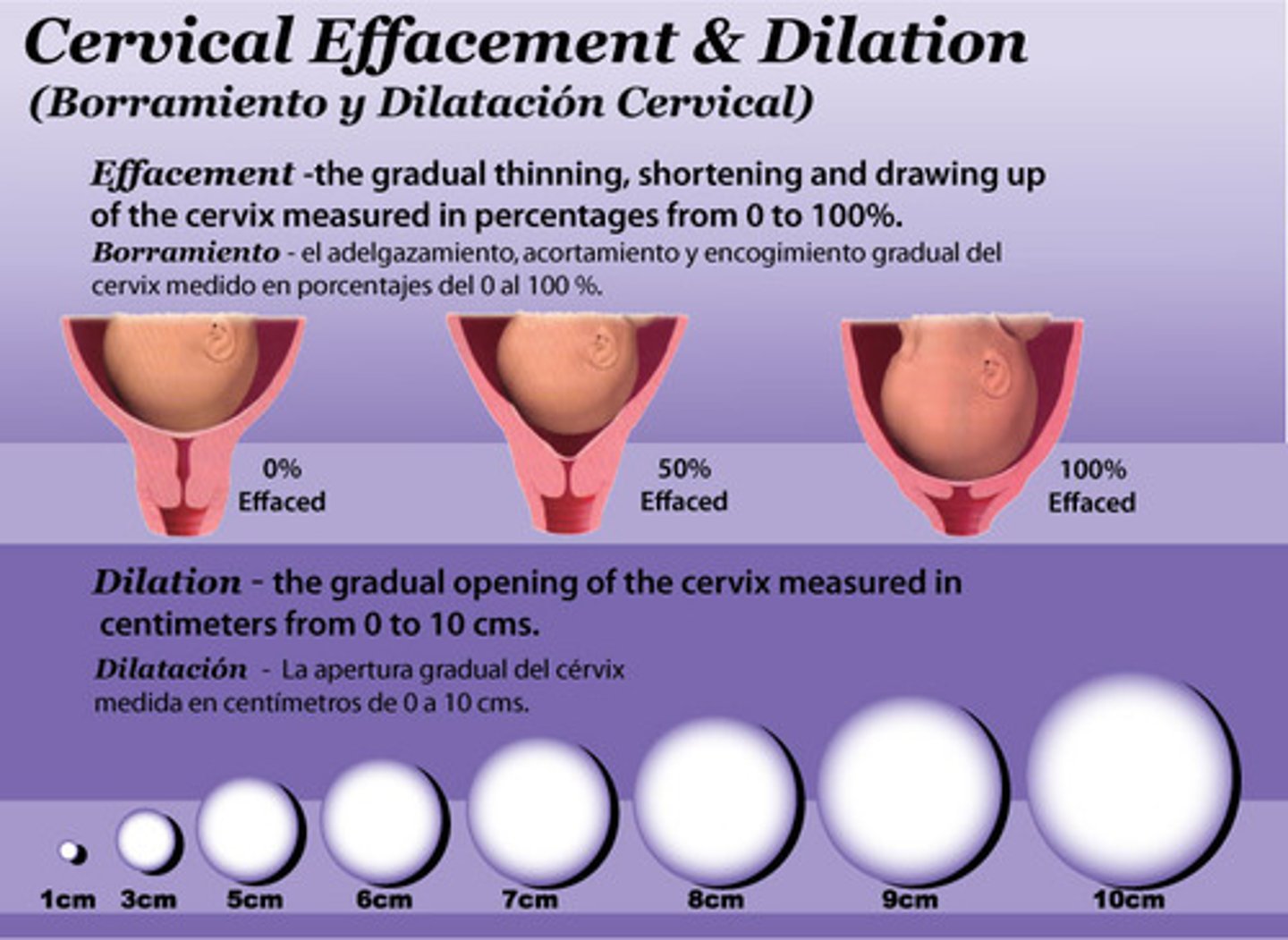 <p>thinning of the cervix for childbirth preparation</p>