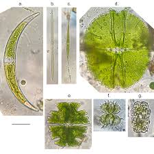 <p>Desmids</p><p>charophyta</p><p>green</p><p>common shapes: globular, disc-like, spindle-like, and star-shaped</p><p>typically unicellular; each cell divided into 2 semi-cells</p><p>lack flagella</p><p>distinctive mirror-image semicells divided by a median constriction or isthmus</p>