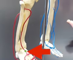 <p>Name the blood vessel.</p>