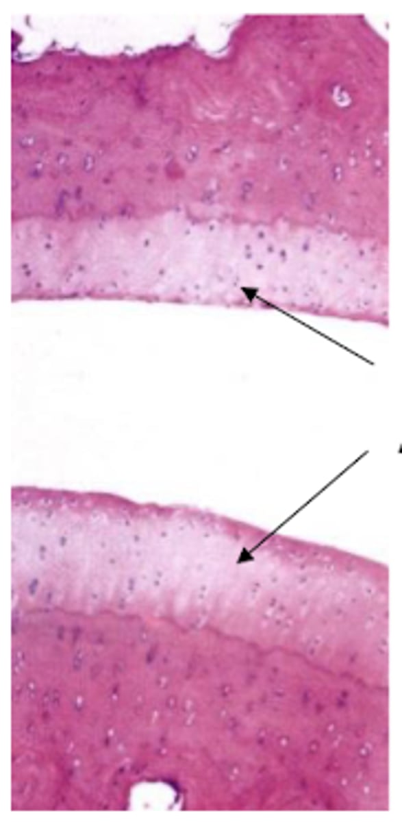 <p>What type of cartilage is shown?</p>