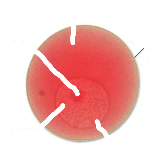 <p>What part of a starfish egg is this?</p>