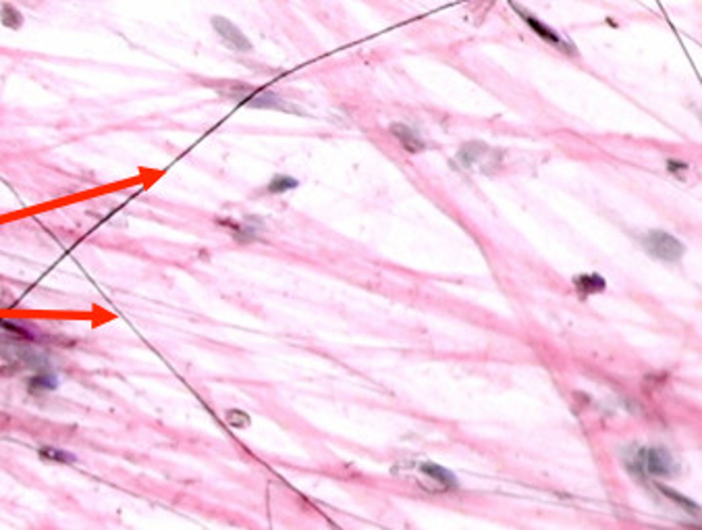 <p>Flexible and "stretchy" fibers that add elasticity to tissue</p>