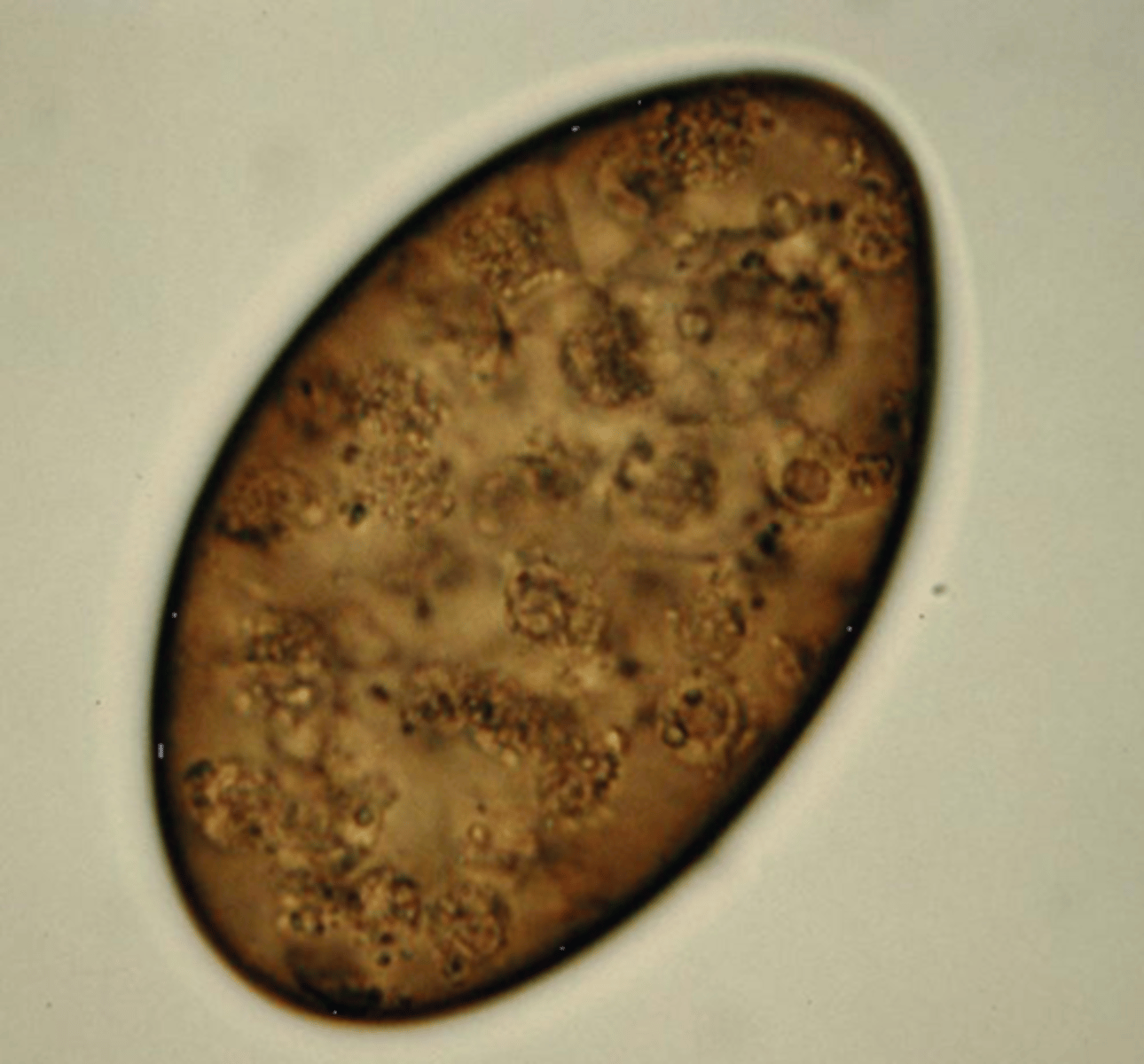 <p>This was found in the stool sample of a dog with no associated clinical signs. What is it?</p>