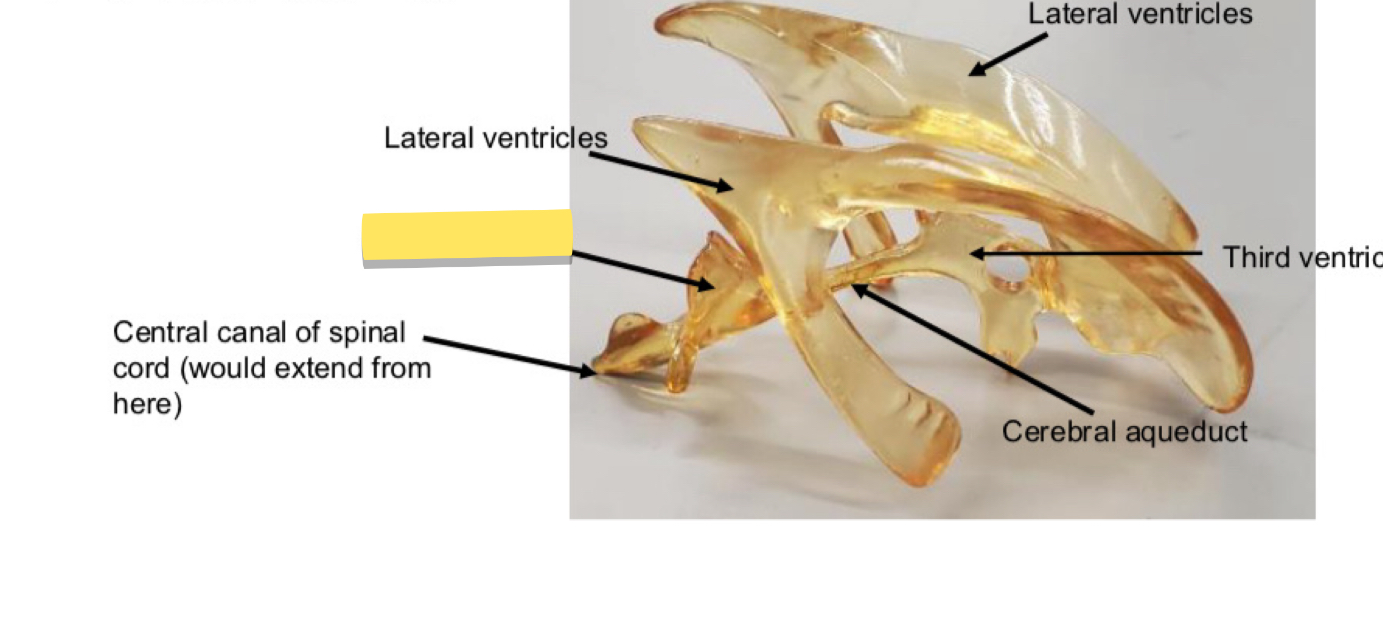 <p>Name this brain ventricle</p>