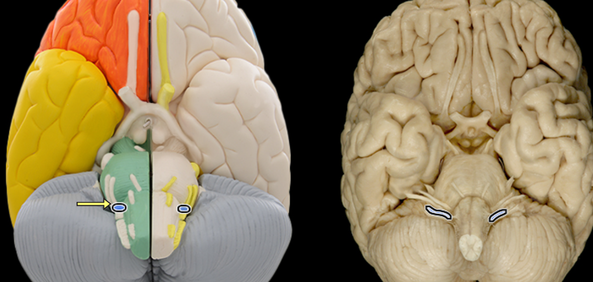 <p>Glossopharyngeal</p>