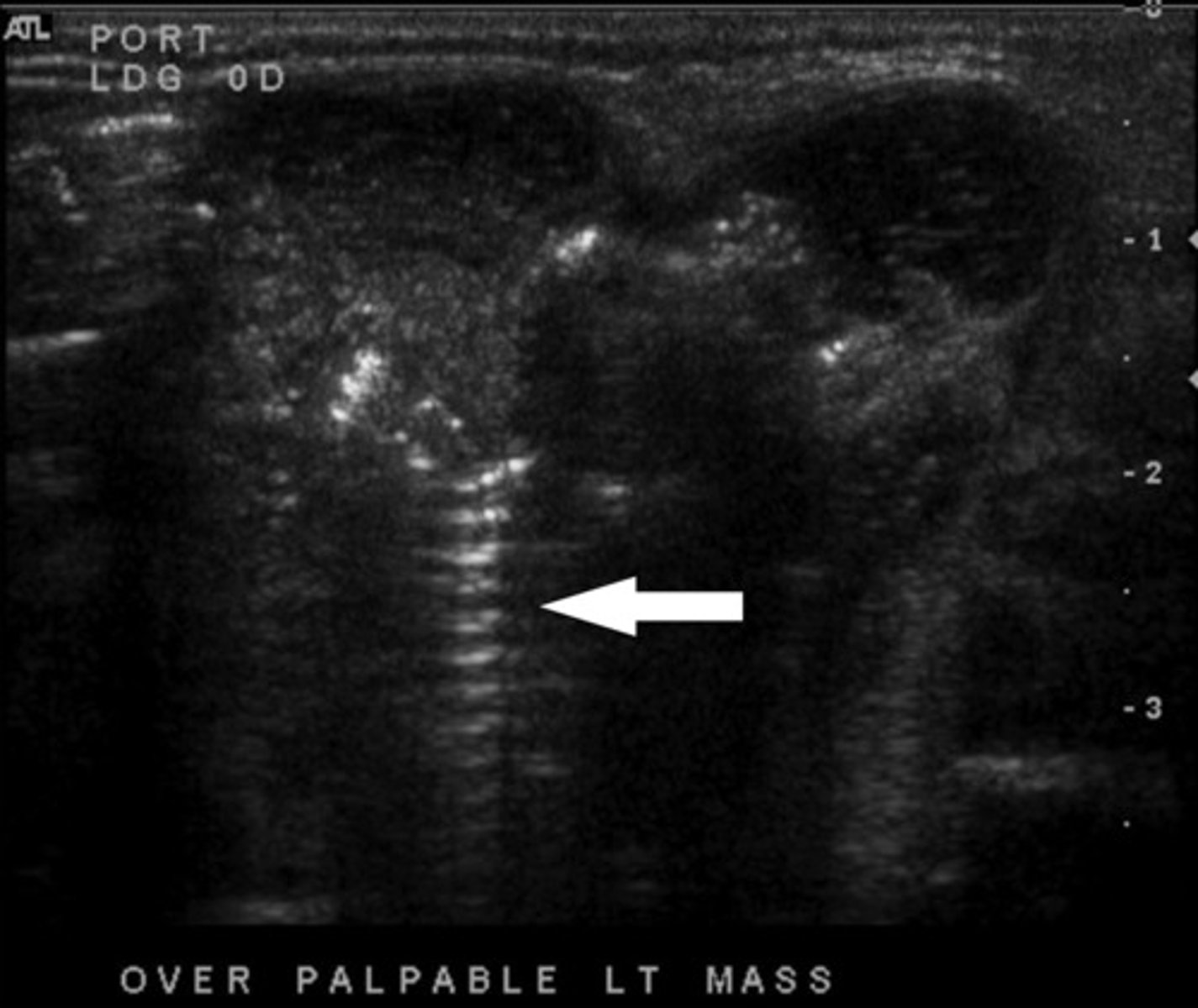 <p>What artifact is this arrow pointing to and how do you know?</p>