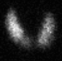 <p>What type of scan is this?</p>