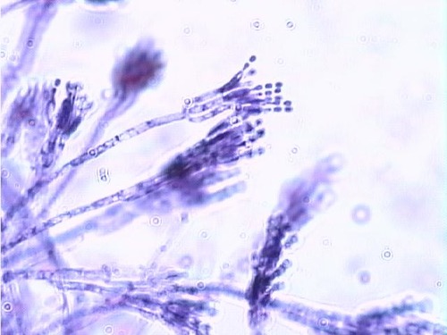 Sac fungi-cup or ascocarp