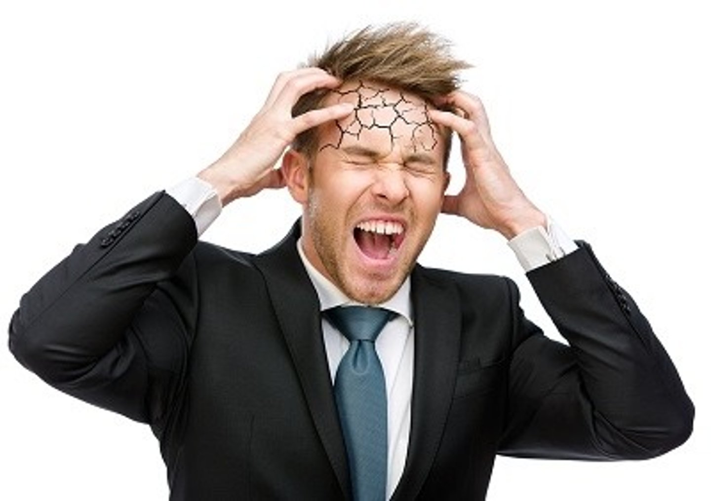 <p>severe headache</p>