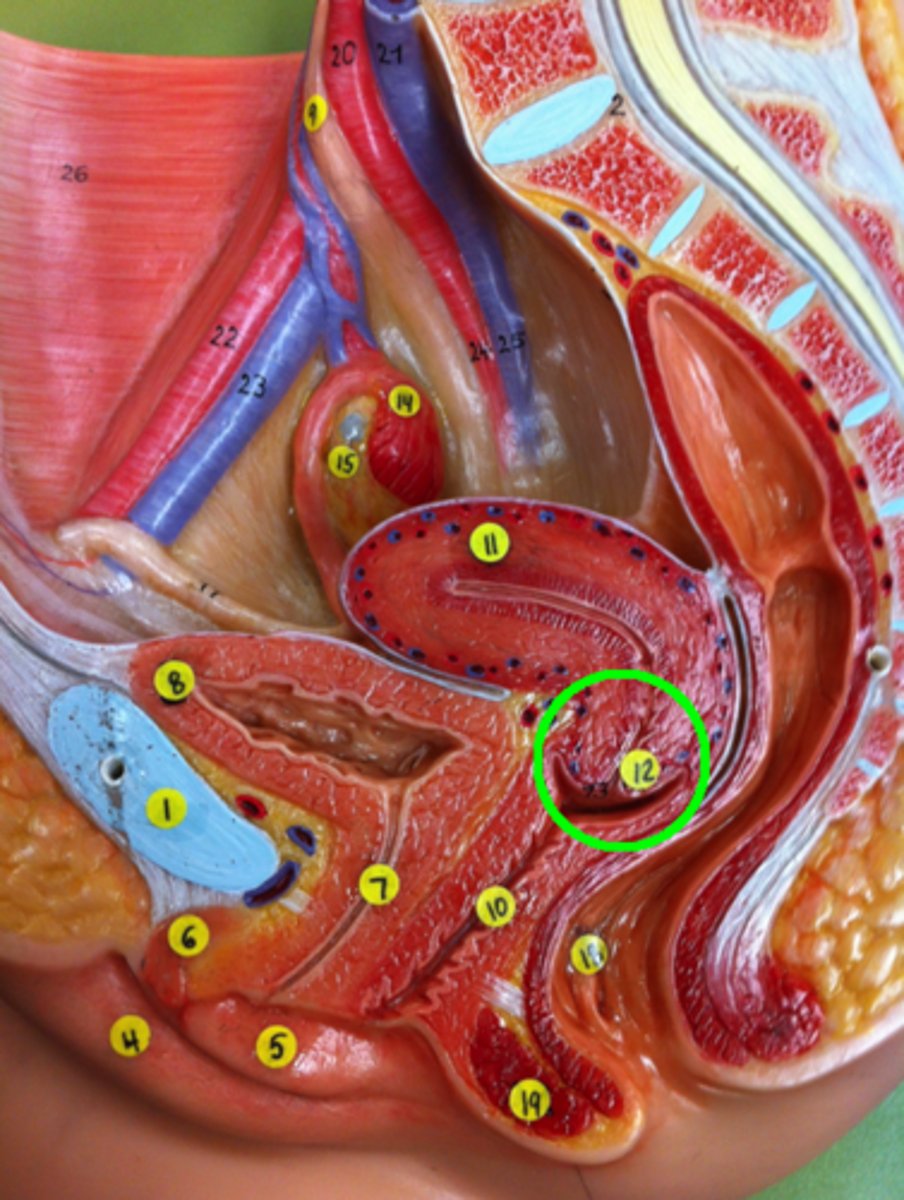 <p>What part of the female reproductive system is this?</p>