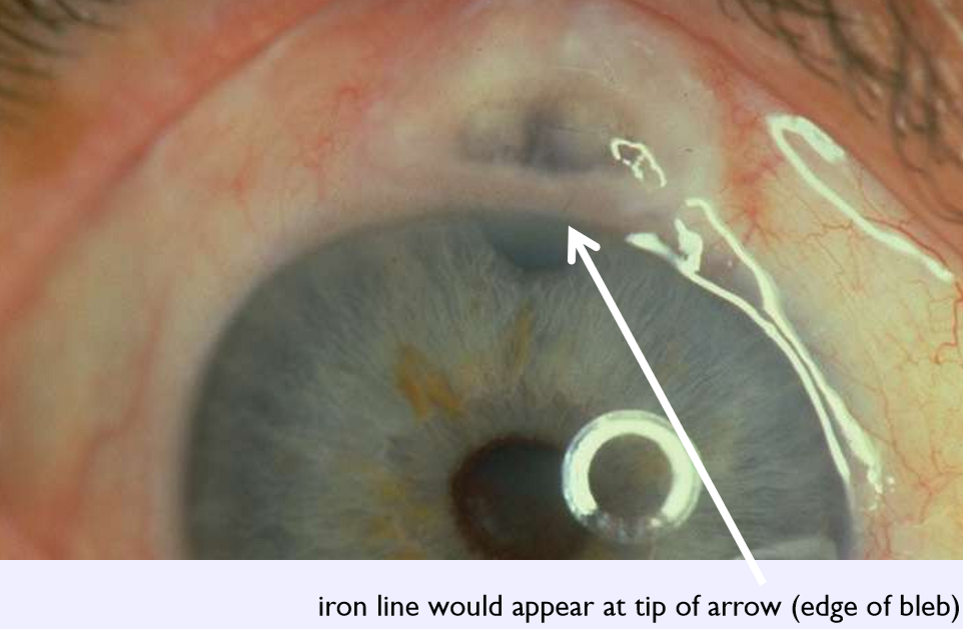 <p>What condition is this?</p>