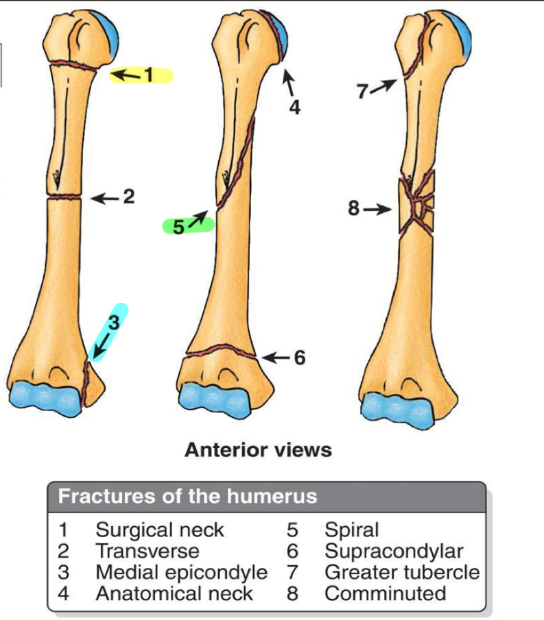 <p>What nerves/vessels are we concerned about if there is a 1, 3 or 5 fracture?</p>