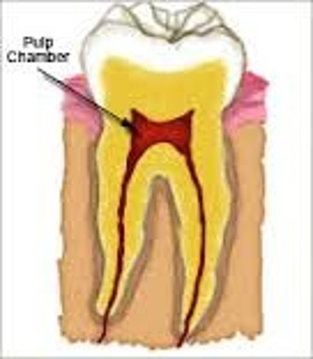 <p>the pulp within the crown of the tooth.</p>