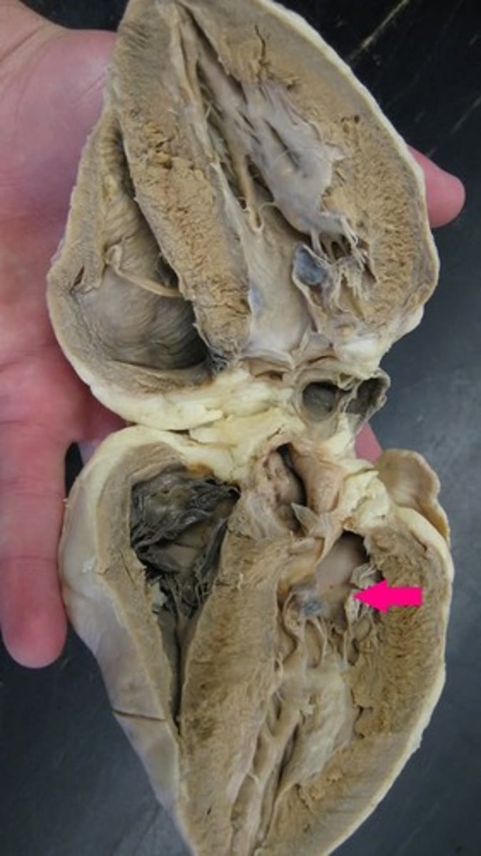 <p>Identify the valve.</p>