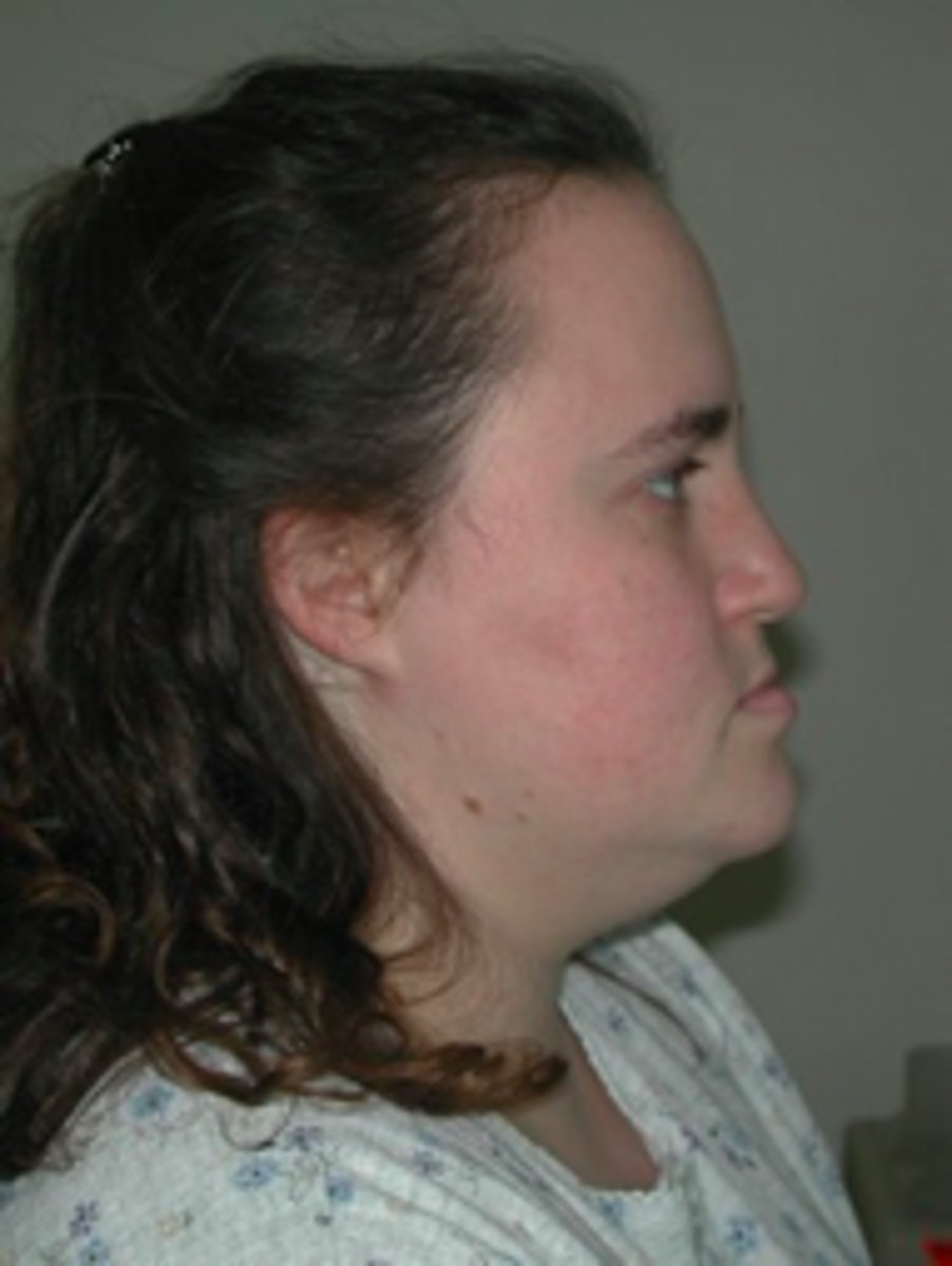 <p>ID the discrepancy:</p>