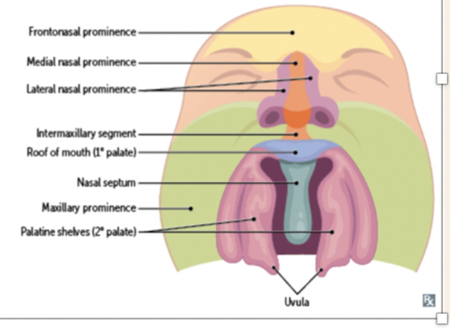 <p>What is the consequence of a failure of the palatal shelves to fuse?</p>