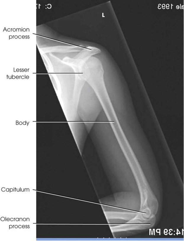 term image