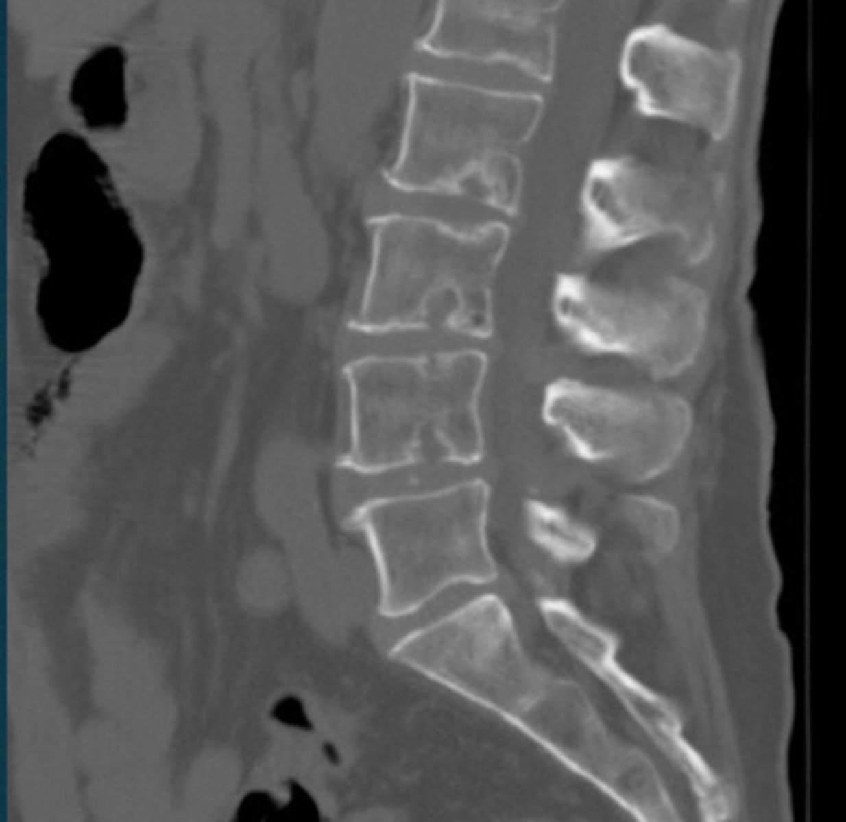 <p>What abnormality is this?</p>