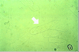 <p>Identify the urine sediment element shown by the arrow.</p>