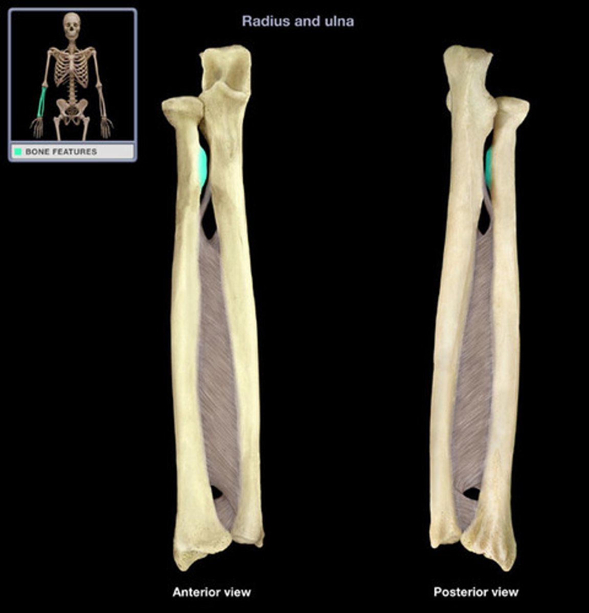 <p>bump on diaphysis</p>