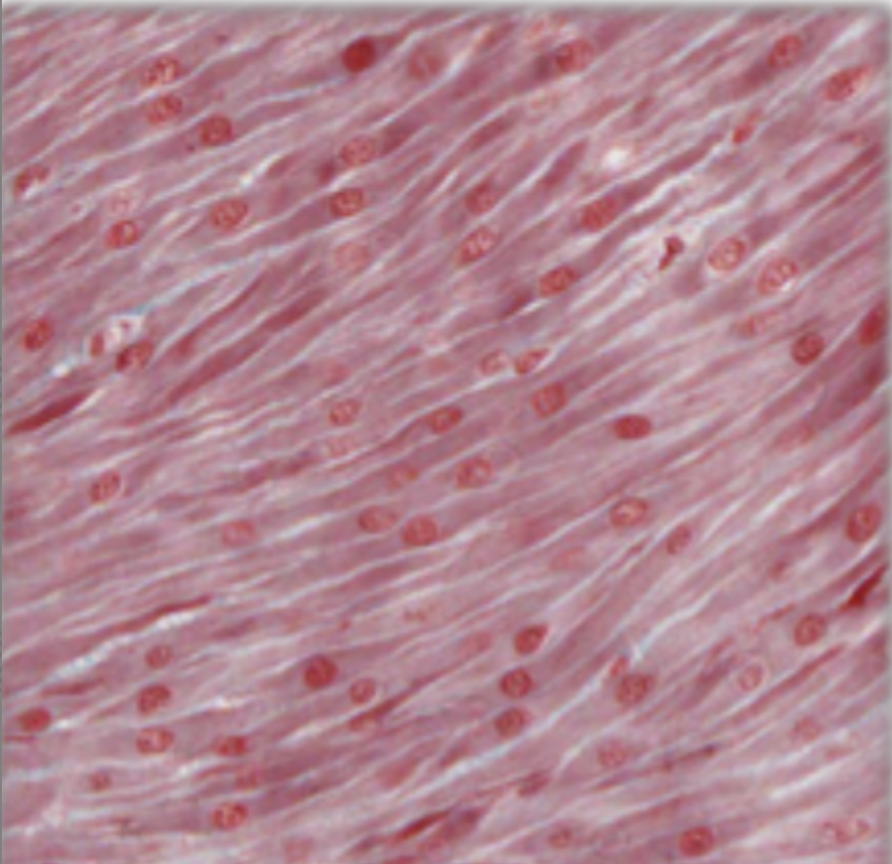 <p>interlinking of tapered cells, various amounts of connective tissue between fibres, cell boundaries difficult to see, nucleus within elongated cells, no striations</p>