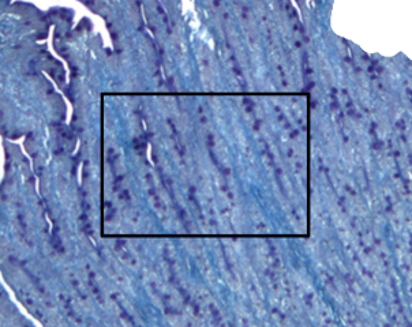 <p>what is the predominate structure in this image</p>