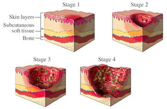 filing the wound, and covering the wound. the cells will fil in from the top layer, if it's deeper (start from the bottom of the wound and fill to the top. angio is making new blood cells, granular- is when the new cells pill in together to fill up the space. Collagen is used to make sure the wound stays moist.