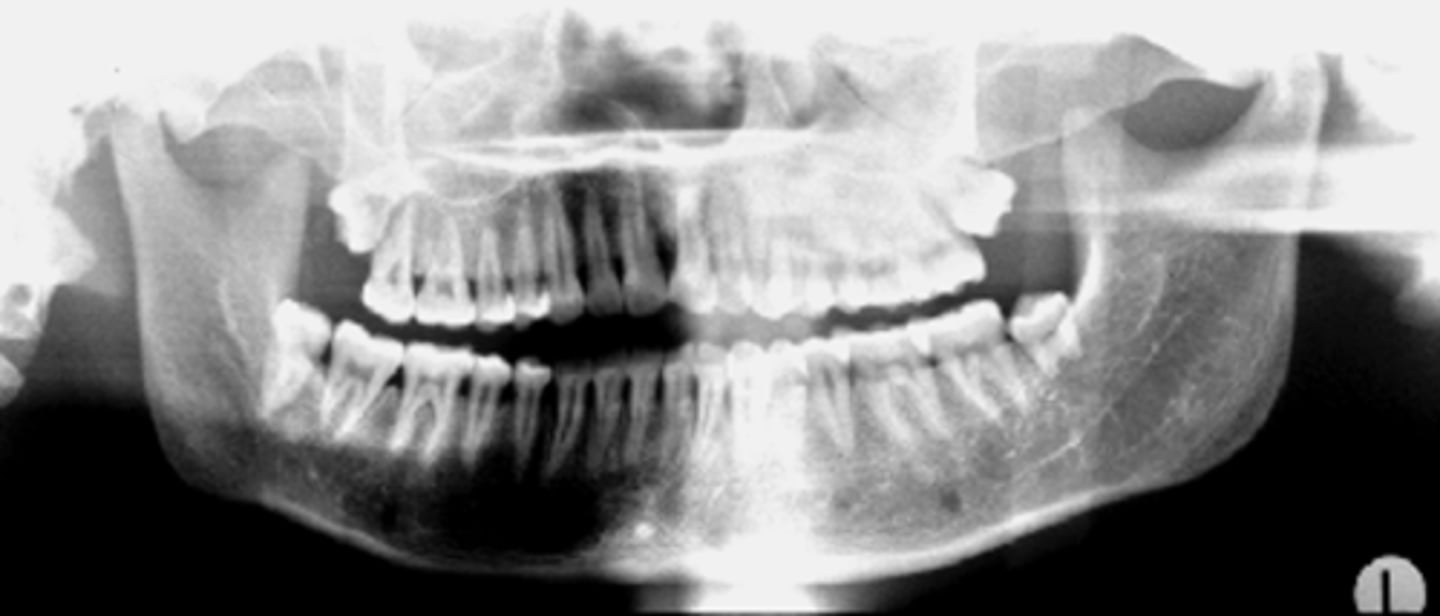 <p>ID the positional error from the radiograph:</p>