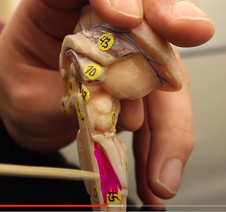 <p>ventricles pg. ~442</p><p>what is this structure </p>
